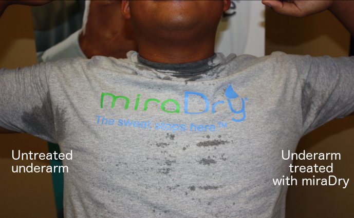 Don’t Let Sweat Be the Highlight of Your Summer