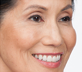 How Long Does Botox Last and What Are the Benefits?