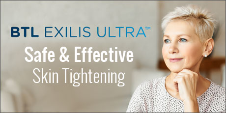 Exilis Ultra Skin Tightening