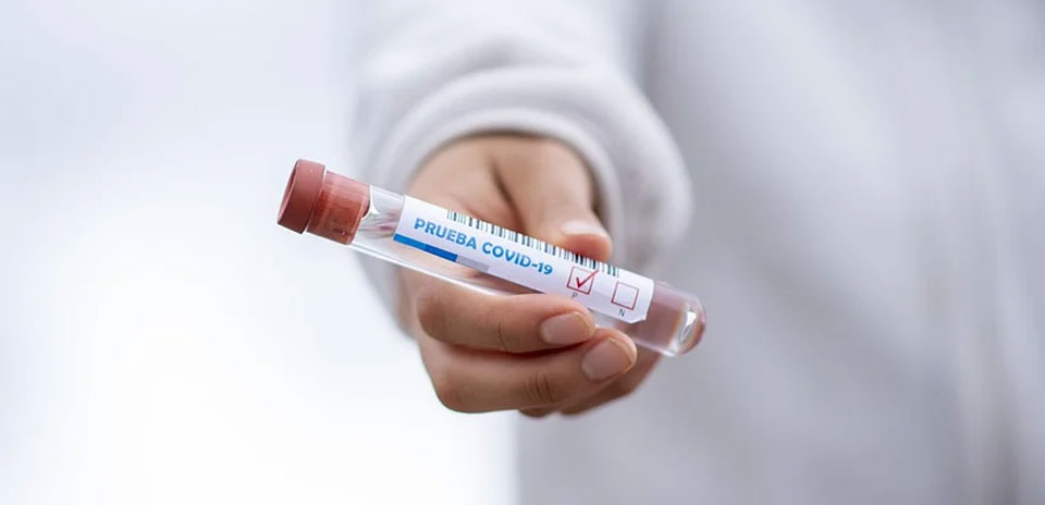 COVID-19 Update as of Mid-August 2020