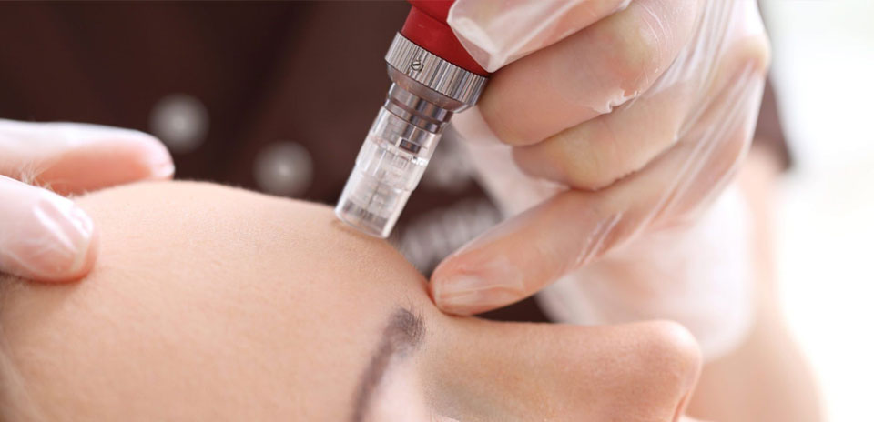 What’s New in Facial and/or Scar Resurfacing