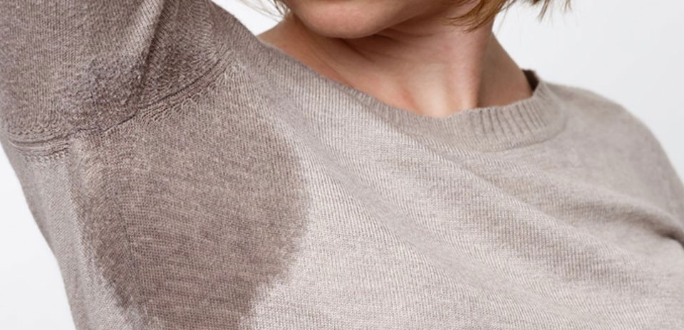 My miraDry Treatment