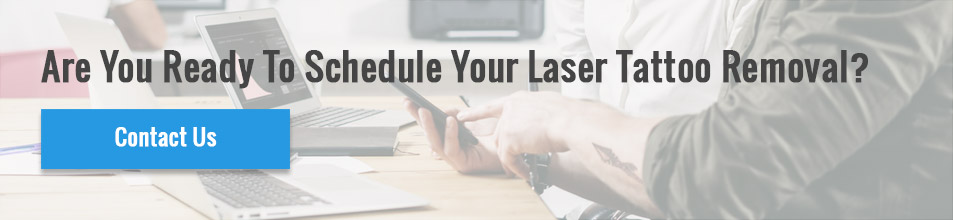 Laser Tattoo Removal Services
