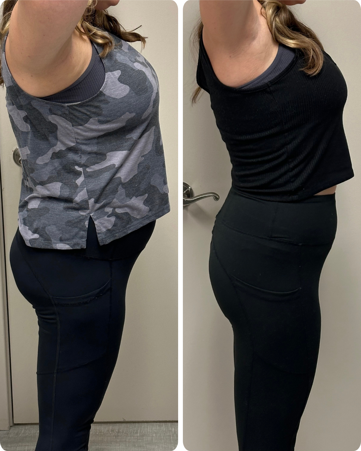 Before and after Semaglutide