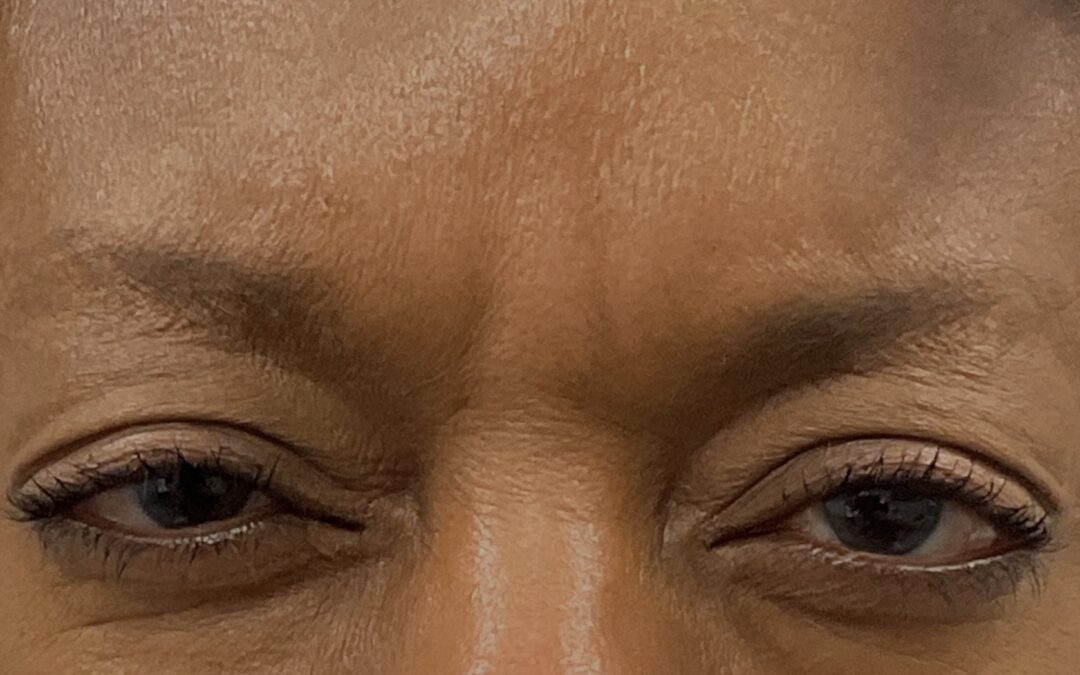 Why Isn’t My ‘Tox Working as Well as it Used to?